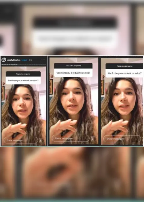 Imagem ilustrativa da imagem Ex-BBB Gizelly Bicalho passa por cirurgia para retirada de nódulos nos seios