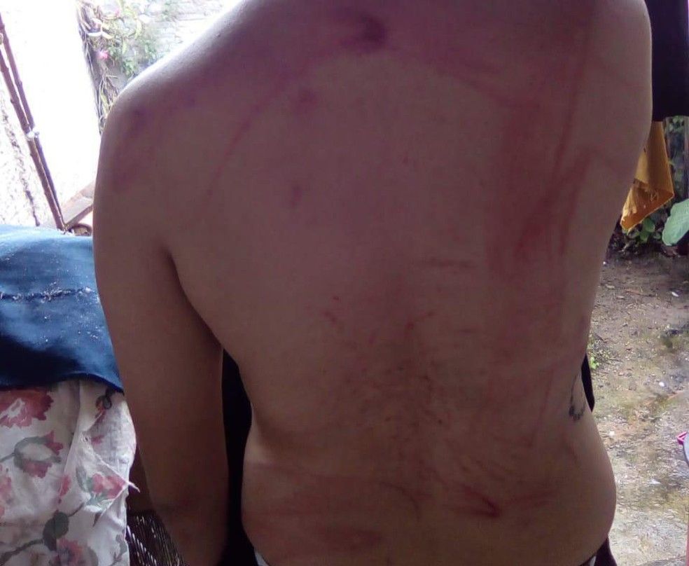 Adolescente de 16 anos foi espancada pelo pai por ser lésbica, na Bahia (Foto: Divulgação/Polícia Civil)
