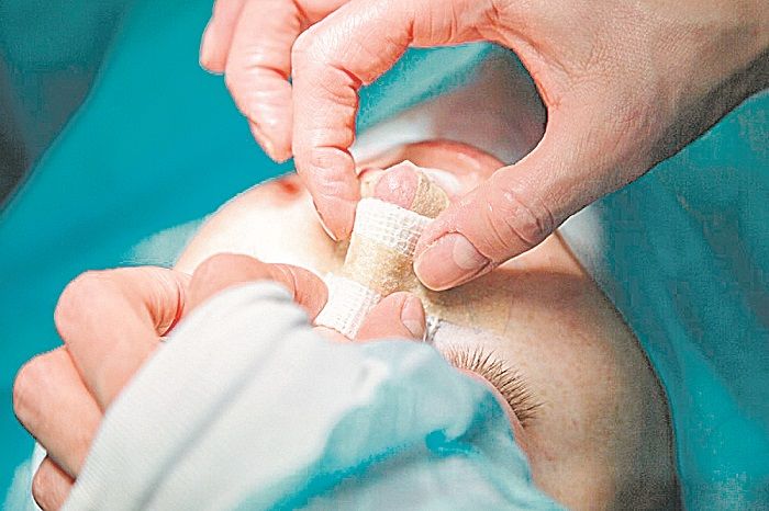 Paciente durante cirurgia no nariz (Foto: Divulgação)