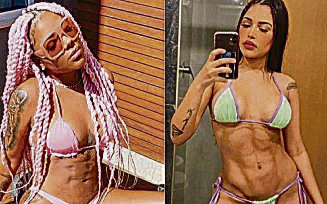 A cantora Ludmilla e a ex-BBB Flay exibiram o resultado da Lipo LAD nas redes sociais. Nova técnica de beleza virou febre entre celebridades (Foto: Reprodução/Instagram)
