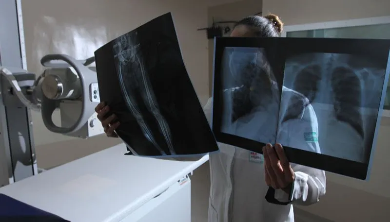 Médica mostra raio X: campanha faz alerta para os riscos da   radiação