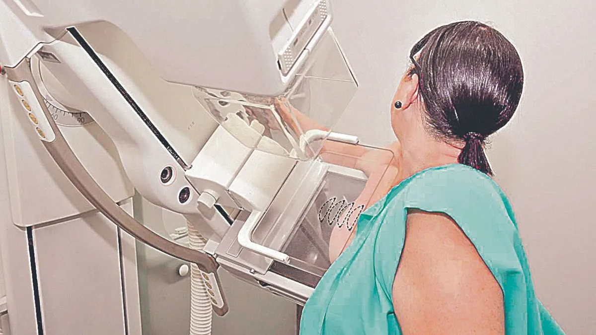 Imagem ilustrativa da imagem Exame de graça para detectar câncer de mama