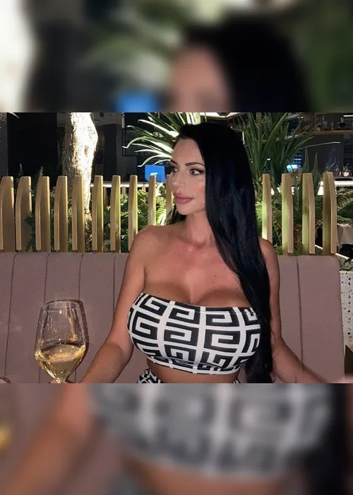 Imagem ilustrativa da imagem "Assusto os bons homens”, diz modelo que gastou R$ 260 mil em cirurgias