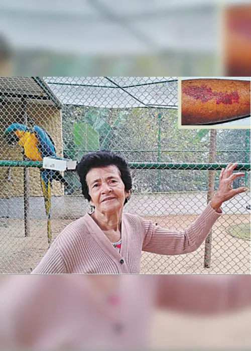 Imagem ilustrativa da imagem Manchas roxas na pele têm relação com a idade
