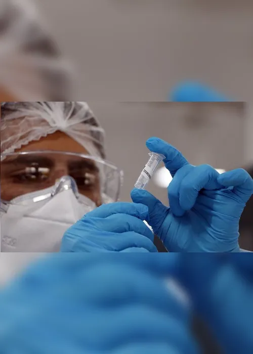 Imagem ilustrativa da imagem Brasil registra média móvel de 483 mortes por dia devido a covid-19