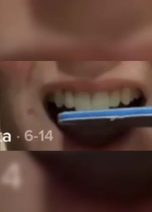 Imagem ilustrativa da imagem Dentistas fazem alerta para desafio no TikTok de lixar os dentes