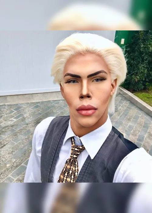 Imagem ilustrativa da imagem Jovem planeja 42 cirurgias para se transformar no boneco Ken, da Barbie