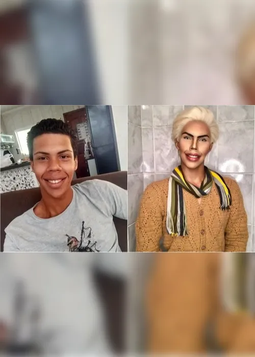 Imagem ilustrativa da imagem Jovem planeja 42 cirurgias para se transformar no boneco Ken, da Barbie
