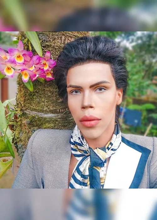 Imagem ilustrativa da imagem Jovem planeja 42 cirurgias para se transformar no boneco Ken, da Barbie