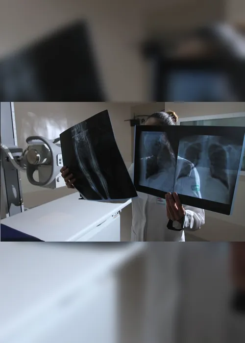 Imagem ilustrativa da imagem Médicos fazem campanha contra excesso de raios x em crianças