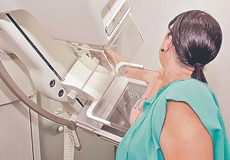 Paciente faz exame de mama: de janeiro até agosto deste ano foram realizadas 24.815 mamografias no Estado