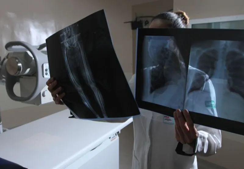 Médica mostra raio X: campanha faz alerta para os riscos da   radiação