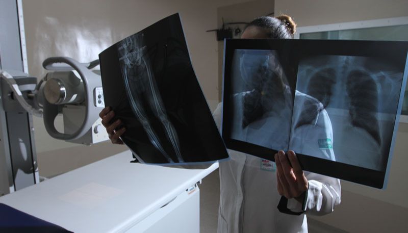 Médica mostra raio X: campanha faz alerta para os riscos da radiação (Foto: Beto Morais / AT)