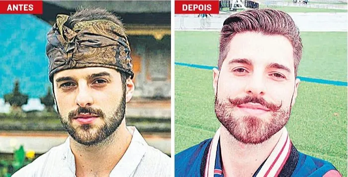 Imagem ilustrativa da imagem Homens em busca da mandíbula perfeita