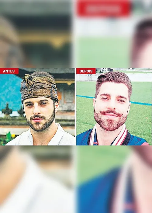 Imagem ilustrativa da imagem Homens em busca da mandíbula perfeita