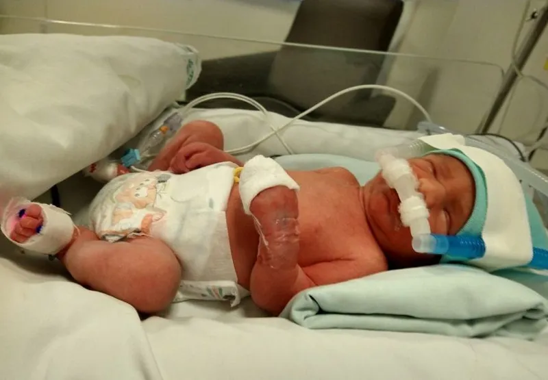 O bebê, João Guilherme, nasceu na tarde da última segunda-feira (6) e está na Utin do mesmo hospital.