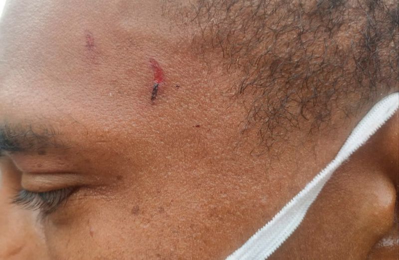 Motorista de aplicativo ficou ferido após entrar em luta corporal com os supeitos (Foto: Kananda Natiely / AT)