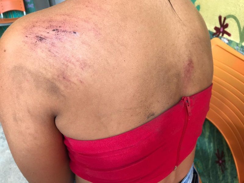 Dona de casa de 27 anos foi agredida pelo companheiro no bairro Areinha, em Viana. (Foto: Manoela Machado)
