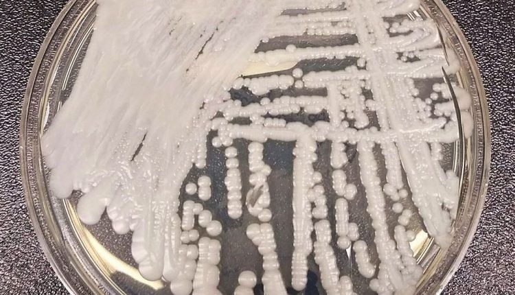 Fungo fatal: laboratórios brasileiros detectam fungo super-resistente a medicamentos pela primeira vez no país (Foto: Divulgação)