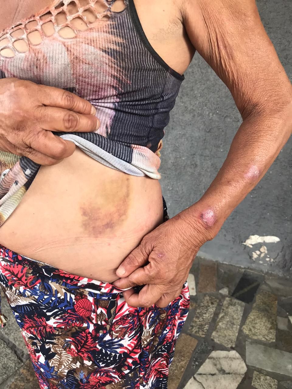 Dona de casa contou que foi agredida por traficantes (Foto: Jaciele Simoura)