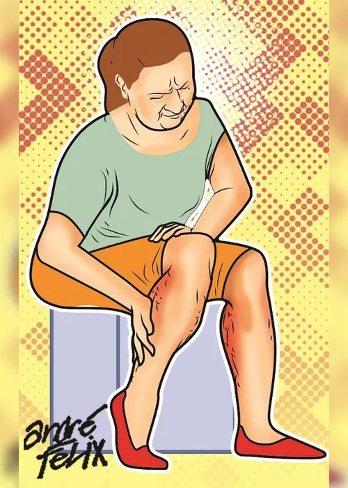 
          Imagem ilustrativa da imagem Já ouviu falar em síndrome da gordura dolorosa?
          