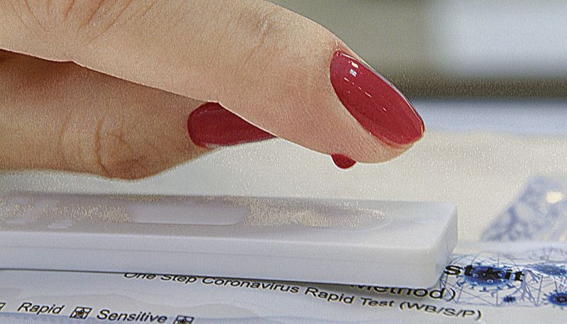 Exame de sangue para detectar a Covid-19: imunidade pode durar mais (Foto: Dayana Souza - 09/06/2020)