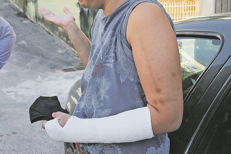 A chapeira, de 27 anos, contou que teve uma discussão com o companheiro e foi espancada por ele na própria casa (Foto: Fábio Nunes/ AT)