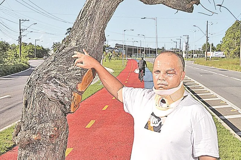 Imagem ilustrativa da imagem Árvore no meio de ciclovia faz médico parar no hospital