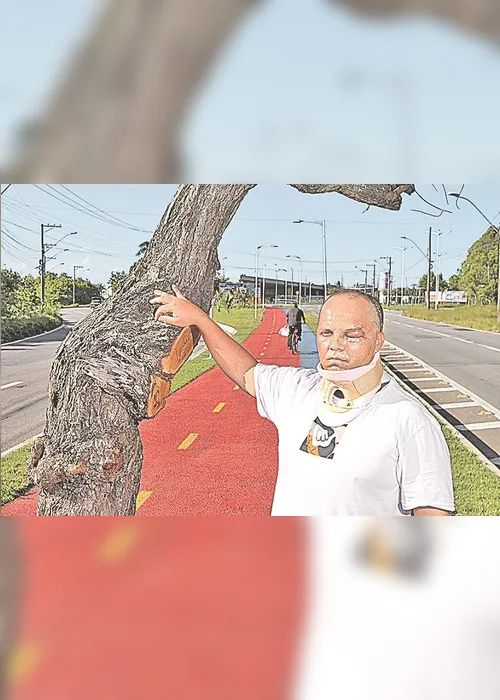 Imagem ilustrativa da imagem Árvore no meio de ciclovia faz médico parar no hospital