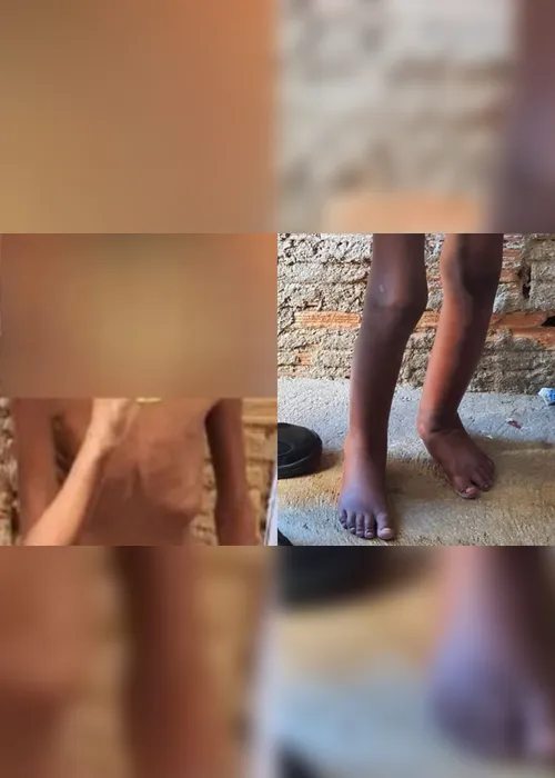Imagem ilustrativa da imagem Vaquinha online arrecada R$ 57 mil para menino que era mantido em barril