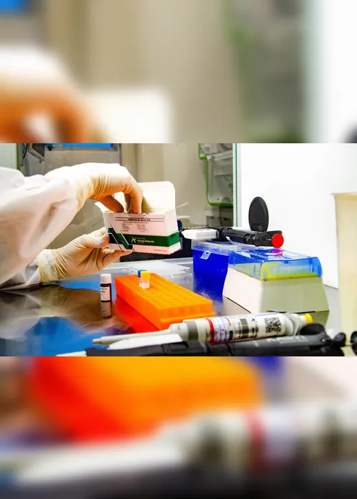 Imagem ilustrativa da imagem Secretário de Estado da Saúde fala sobre combate à Covid-19. Acompanhe