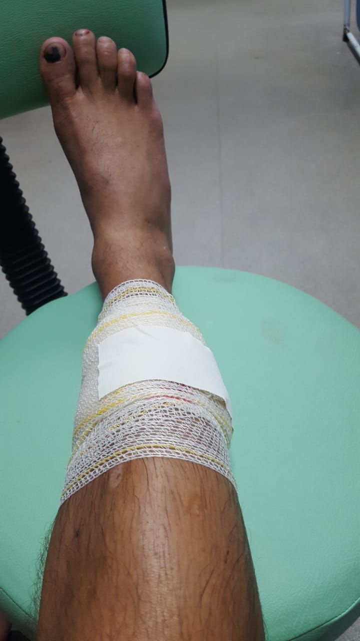 Um confeiteiro de 36 anos foi baleado na perna após reagir a um assalto (Foto: Arquivo Pessoal)