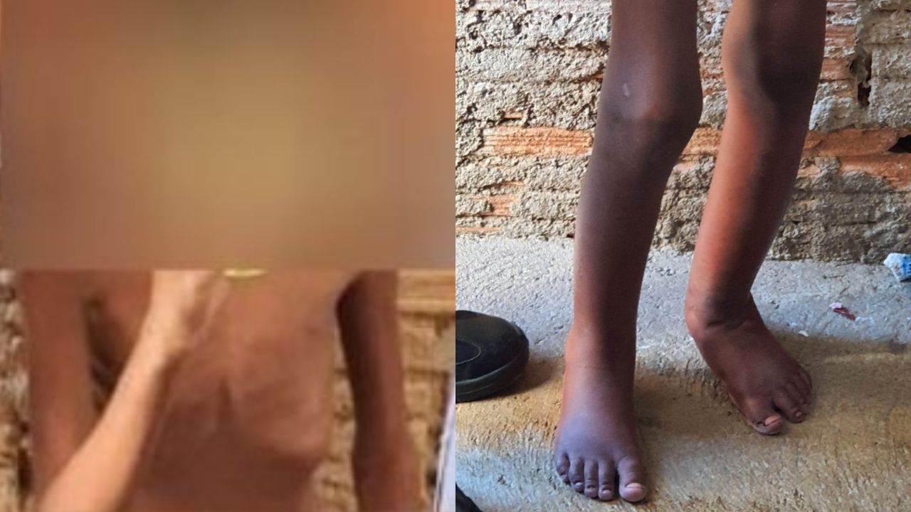 Menino de 11 anos era mantido em barril (Foto: Reprodução)