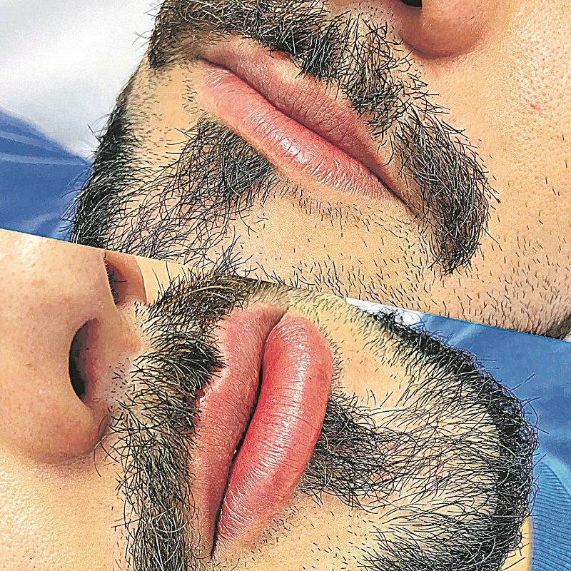 Imagens mostram o antes e o depois (Foto: Divulgação)