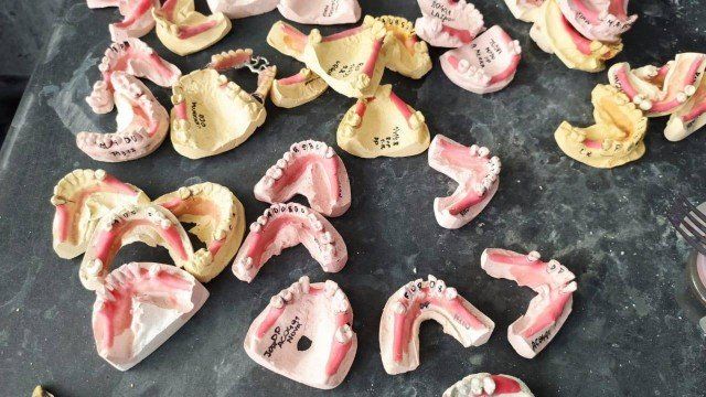 Próteses eram compradas pela metade do preço em cemitérios e restauradas. (Foto: Divulgação)