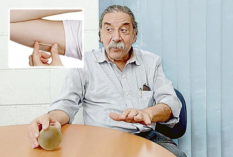 Médico Luis Bahamondes disse que o método, que consiste em 
um implante de bastonete flexível  no braço (destaque), pode beneficiar 20 milhões de mulheres no Brasil