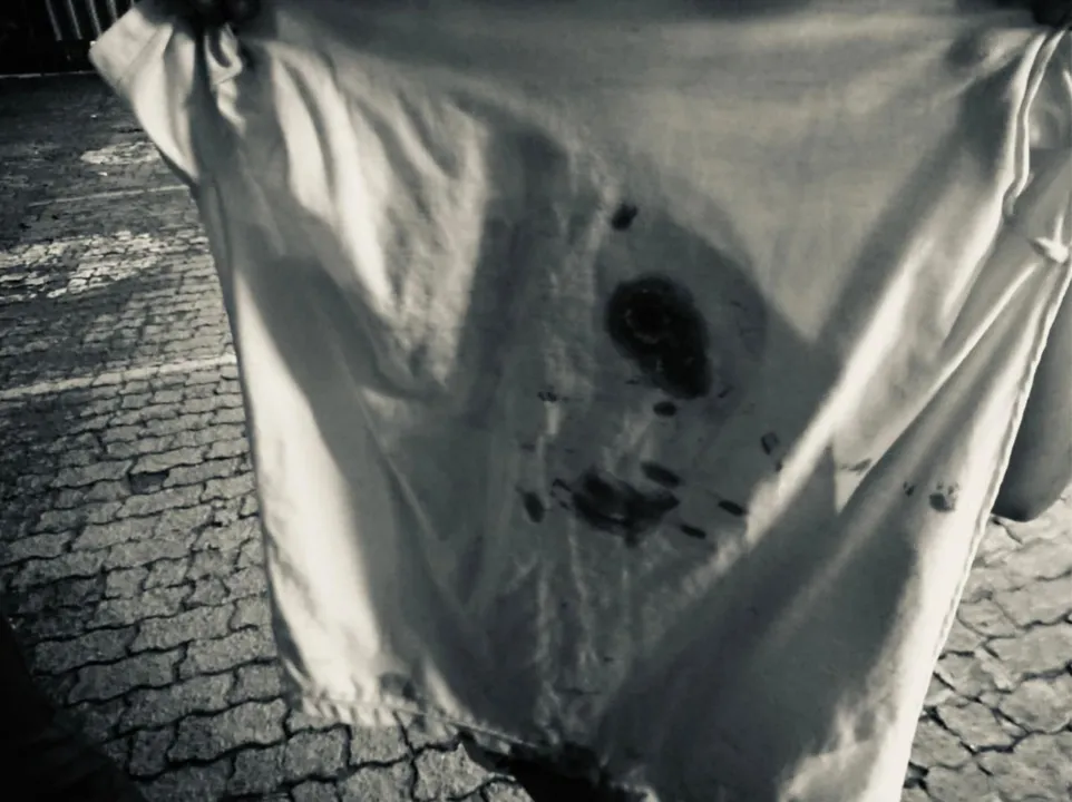 Imagem ilustrativa da imagem Menina de 11 anos é atingida nas costas por bala perdida na Serra