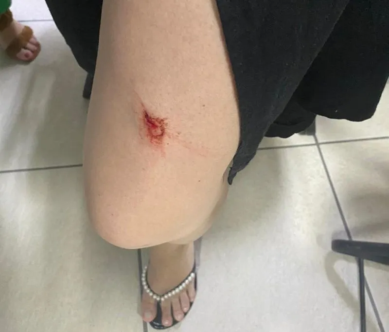 Imagem ilustrativa da imagem Grávida é agredida com chave de fenda durante roubo em apartamento em Vitória