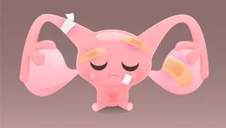 Imagem ilustrativa da imagem Como vencer a endometriose?