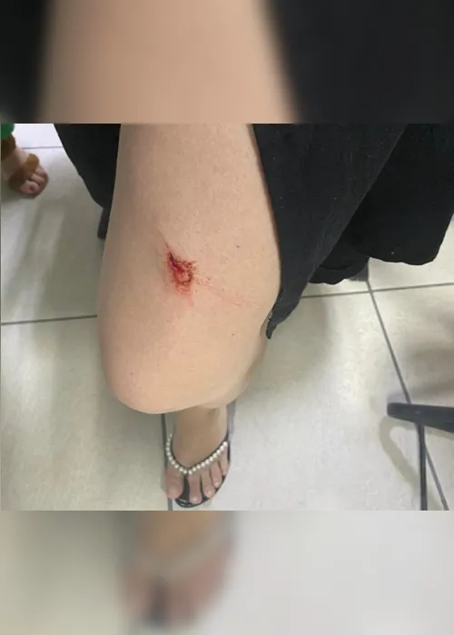 Imagem ilustrativa da imagem Grávida é agredida com chave de fenda durante roubo em apartamento em Vitória