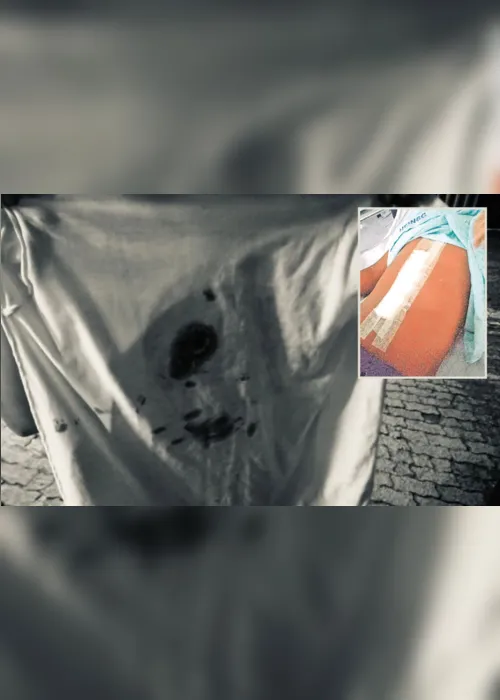 Imagem ilustrativa da imagem “Minha filha escapou da morte”, diz mãe de menina atingida por bala perdida na Serra