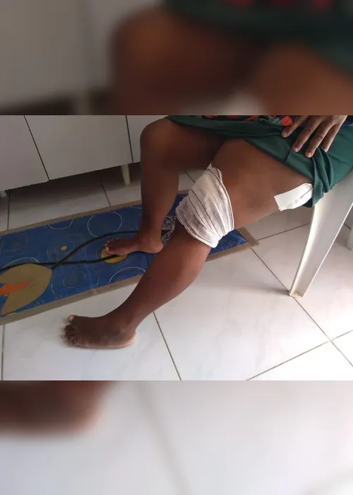 Imagem ilustrativa da imagem Missionária pula em cima de criança durante tiroteio e acaba baleada em Vila Velha