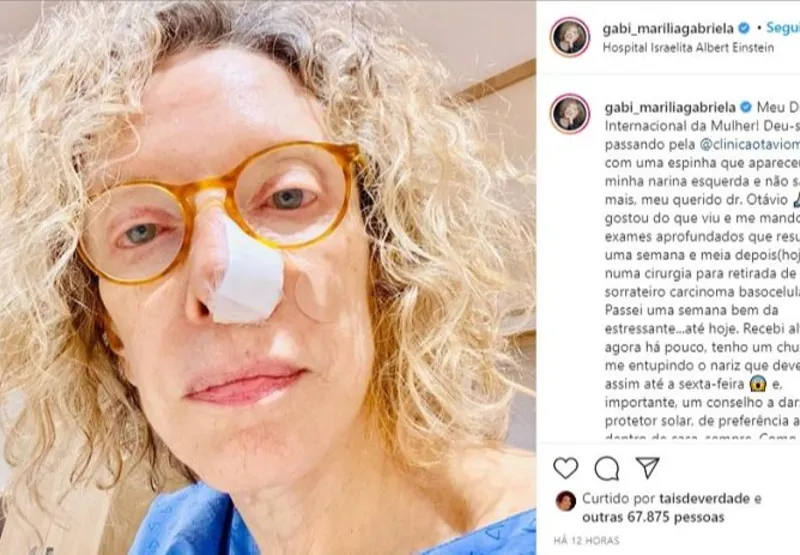 Marilia Gabriela teve câncer de pele no nariz