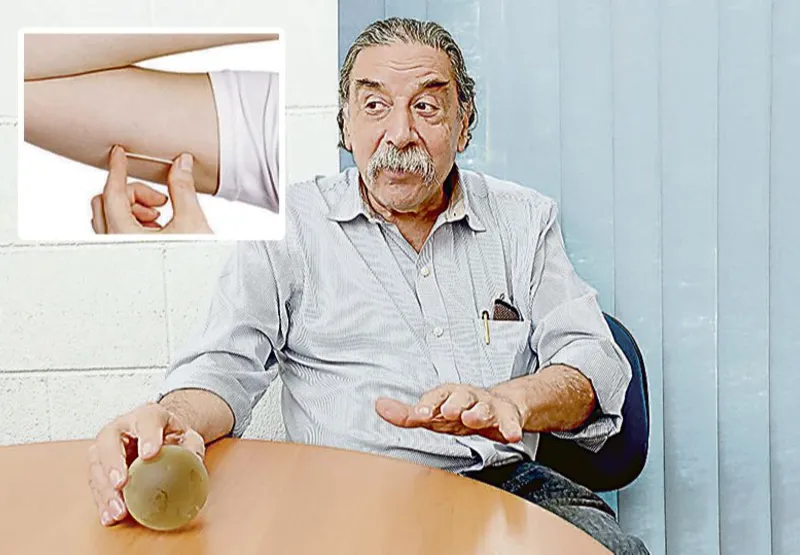 Médico Luis Bahamondes disse que o método, que consiste em 
um implante de bastonete flexível  no braço (destaque), pode beneficiar 20 milhões de mulheres no Brasil