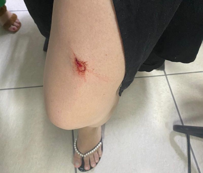 Durante as agressões, o suspeito usou uma chave de fenda para ferir a gestante, chegando a atingi-la na perna (Foto: Acervo Pessoal)