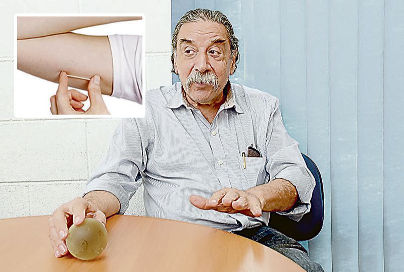 Médico Luis Bahamondes disse que o método, que consiste em um implante de bastonete flexível no braço (destaque), pode beneficiar 20 milhões de mulheres no Brasil (Foto: Unicamp/ Divulgação )