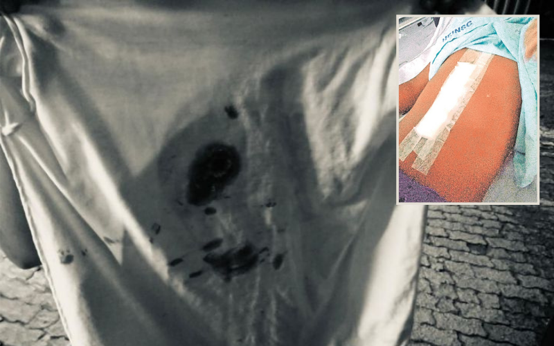Camisa que criança (destaque) usava quando foi atingida pela bala (Foto: Divulgação/Acervo Familiar)