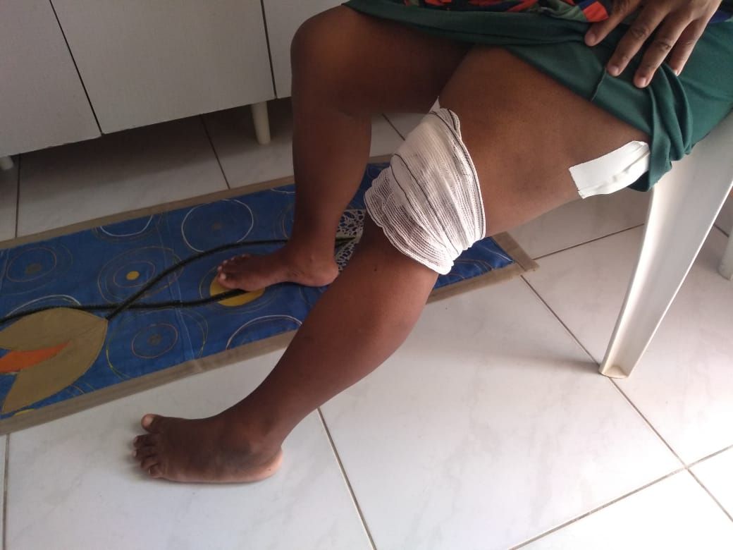 Vítima foi baleada na perna ao proteger criança (Foto: Fábio Nunes/ AT/ 18/03/2021)
