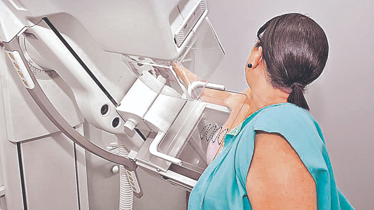 Mulher faz exame de mamografia: marcação do procedimento será feito com mais rapidez na rede pública da Serra (Foto: Arquivo/at)