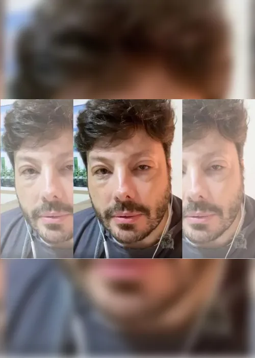 Imagem ilustrativa da imagem Danilo Gentili mostra rosto deformado após alergia